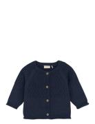 Cardigan Knit Navy Fixoni